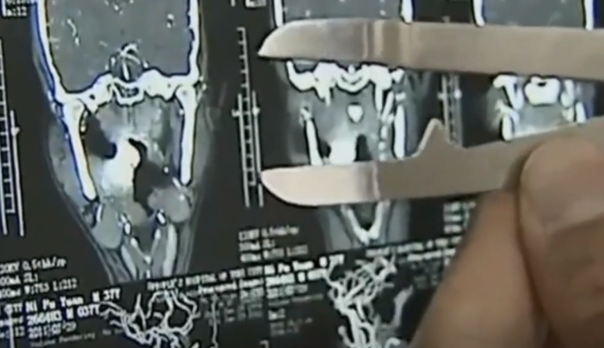 被厄运卡住脖子