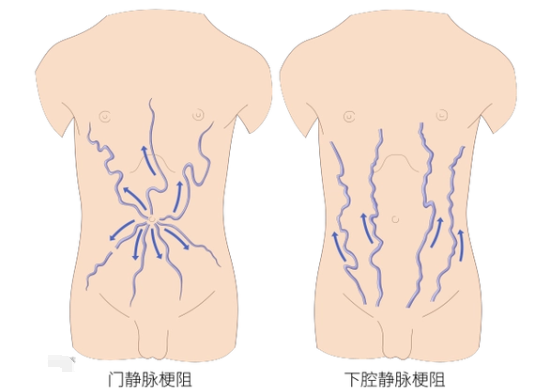 "我一看,肚子又鼓又胀,上面爬满了"海蛇头"