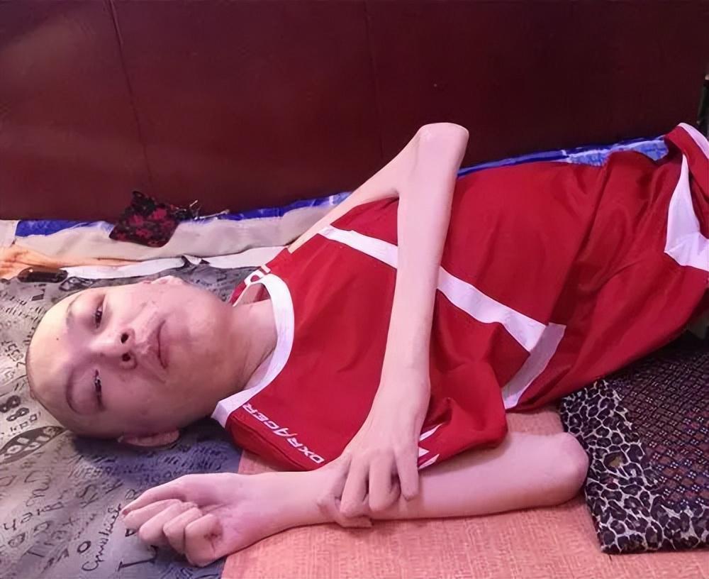 回顾娄滔渐冻症后捐赠遗体遗言惹人泪目当我从未来过