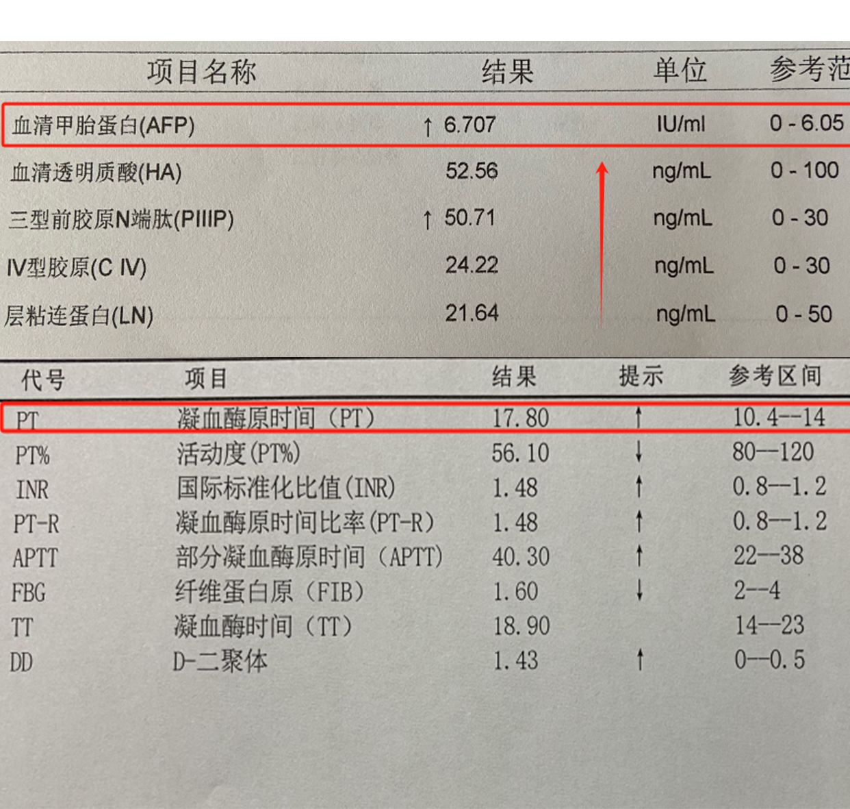 1,凝血酶原活动度 凝血酶原是由肝脏合成的维生素k依赖因子之一,乖谮