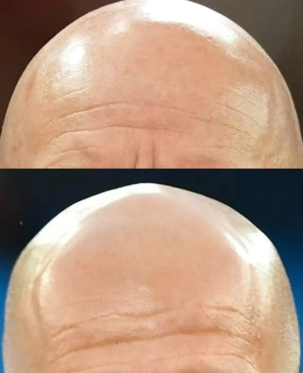 公社是棵常青藤 社员都是藤上的瓜 瓜儿连着藤 藤儿牵着瓜 藤儿越