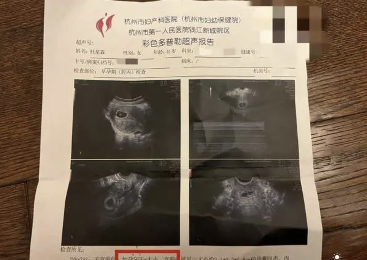 从照片上看,杜星霖的孕肚已经显怀了,丰腴的身材更添几分温婉母爱的