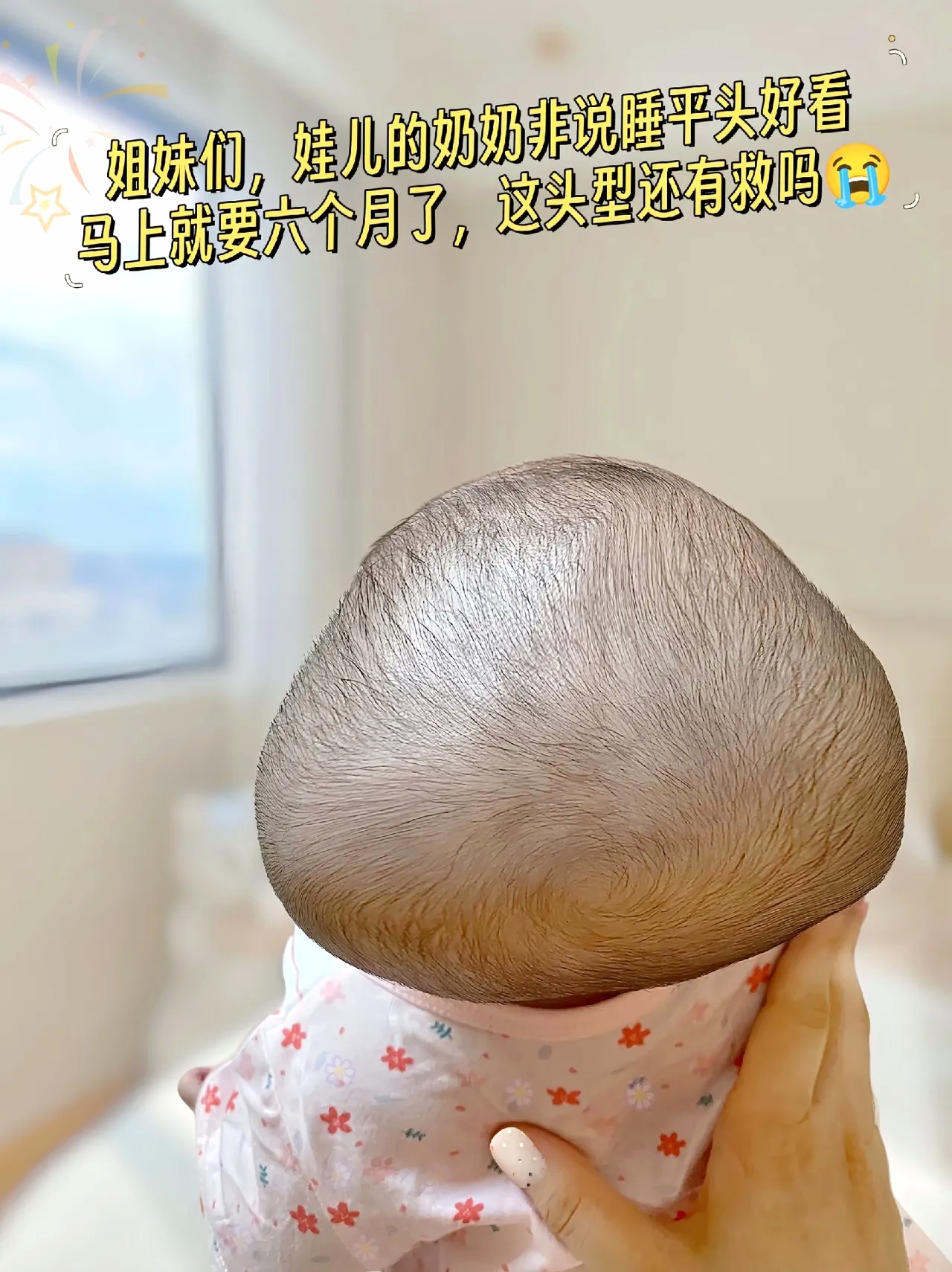 宝宝快六个月了这头型还有救吗?