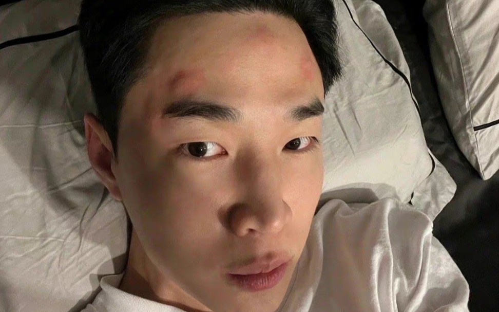 九成人不懂蚊子最大"天敌"是啥?1个土法子,整夜开窗都不怕