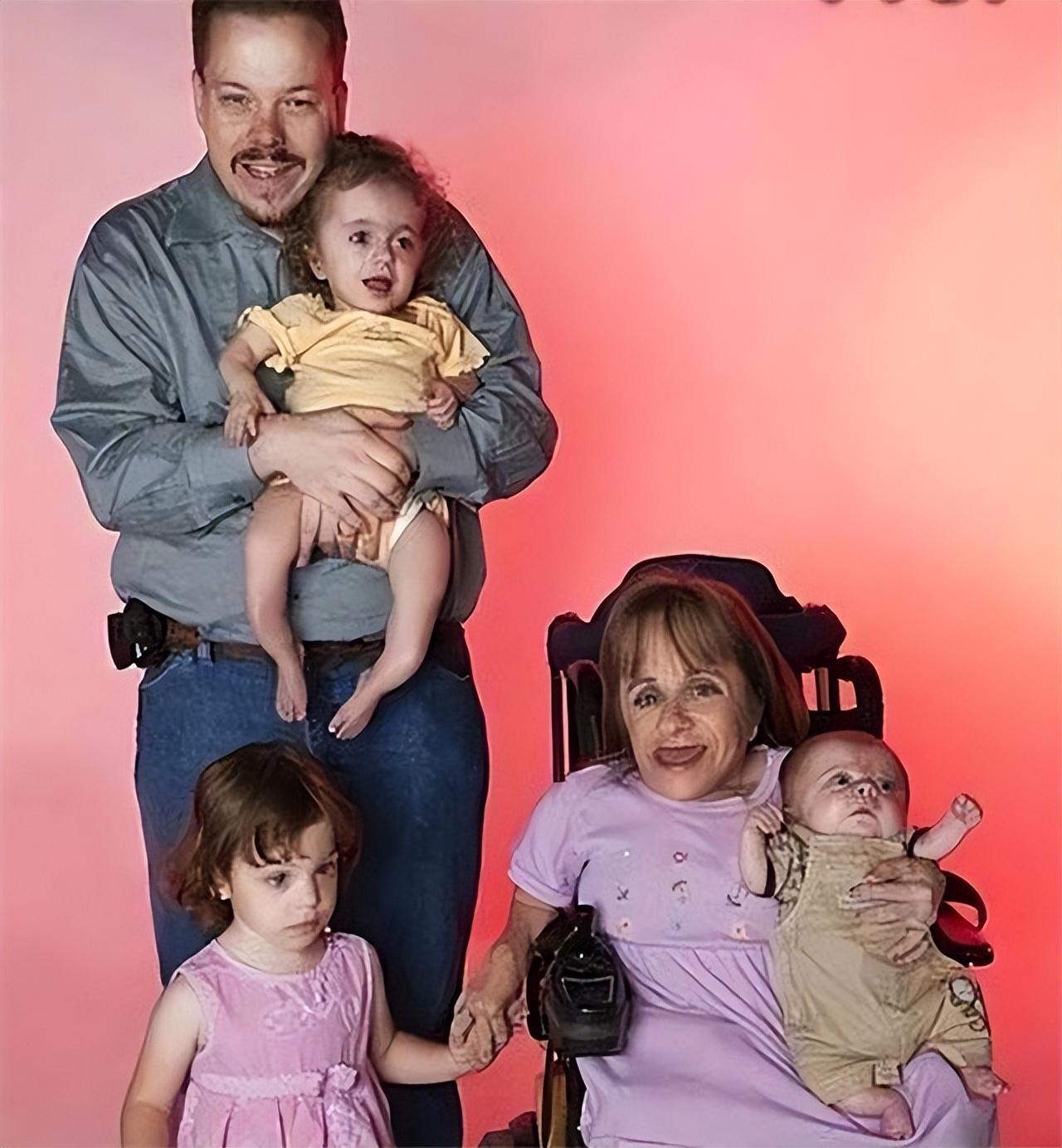 回顾斯黛西身高70厘米不听医生劝告生下3个孩子结局悲惨