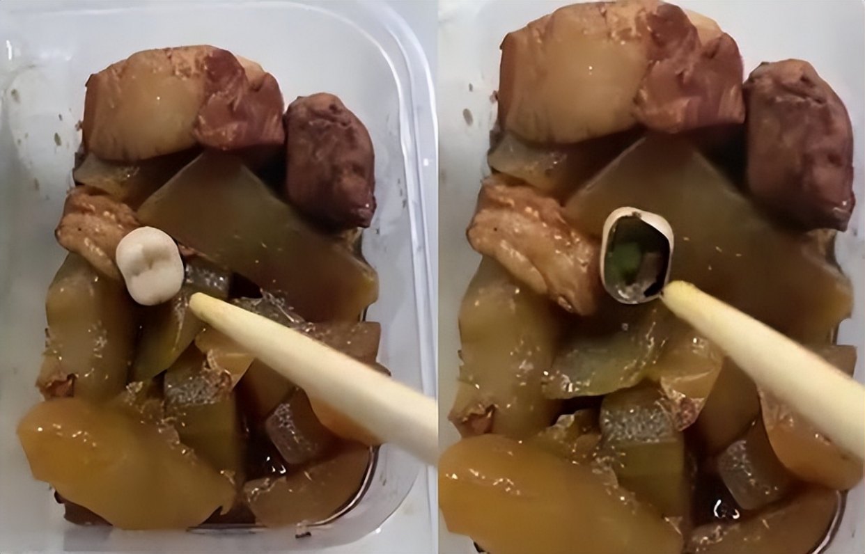江苏南京，食堂盒饭疑似吃出人的牙齿！医院：正在调查