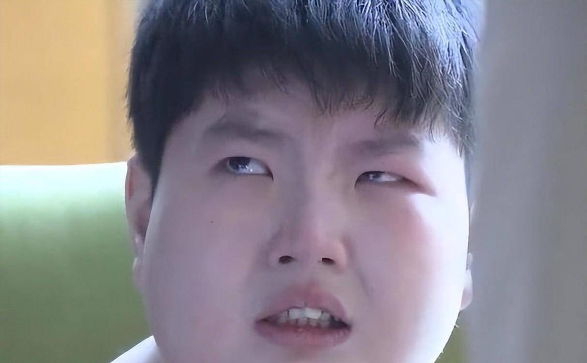 回顾中国小胖徐周磊:14岁体重300斤,一顿吃8碗饭,临终遗愿想减肥