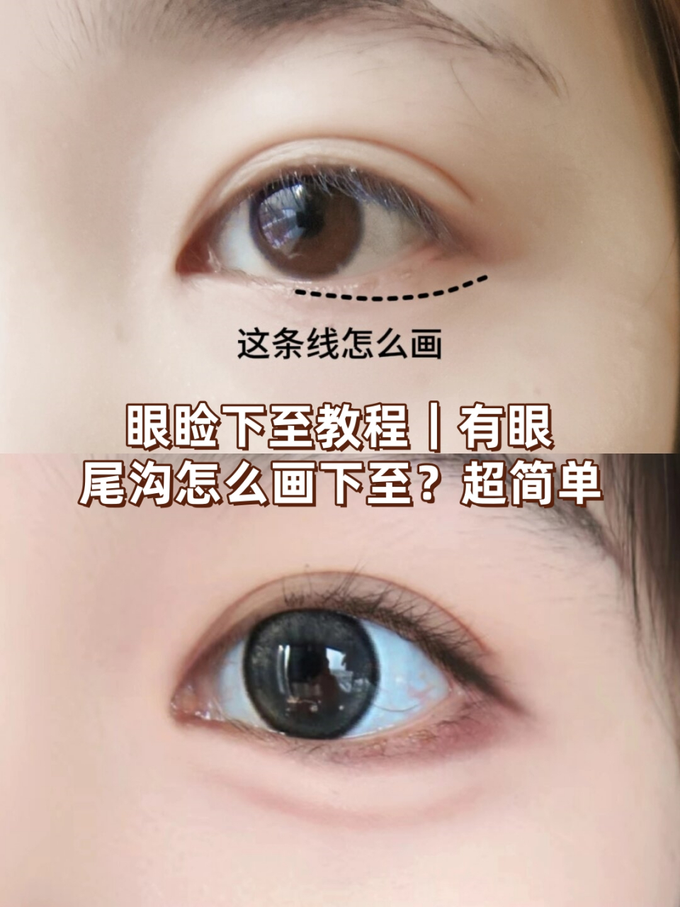 95眼睑下至教程来啦!