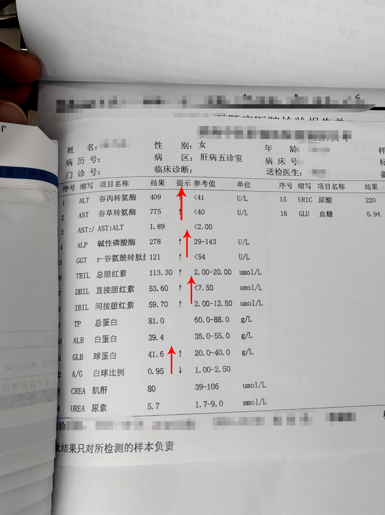 儿童碱性磷酸酶300多图片