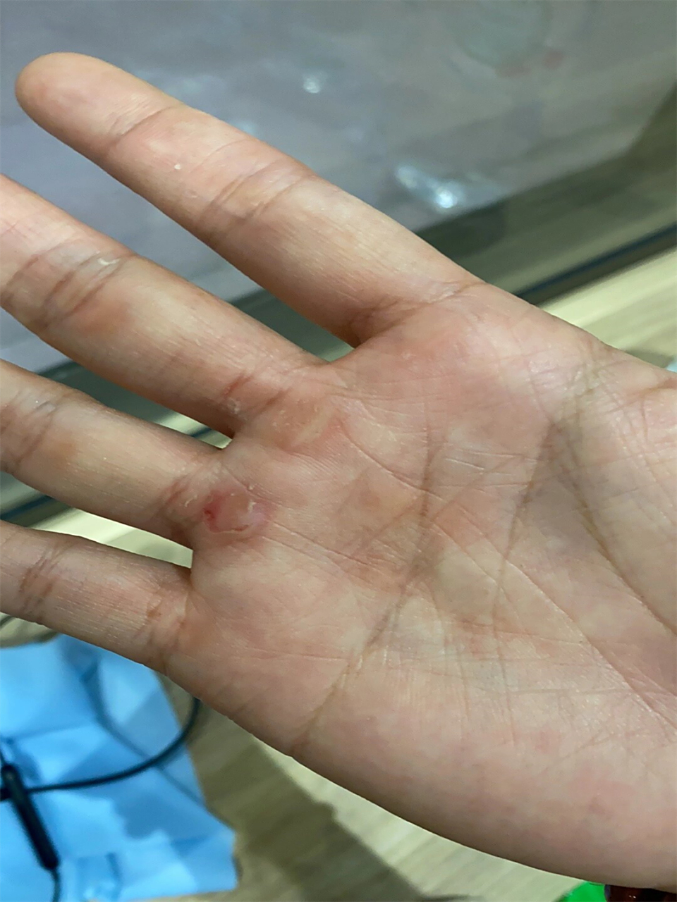 练背之路:磨破双手,只为更强健的背肌💪  每次练背,我