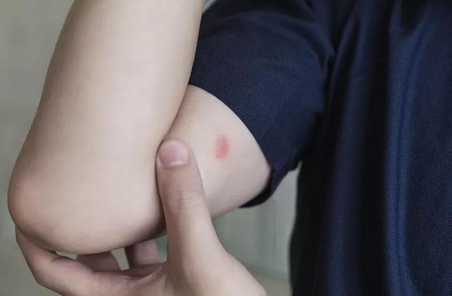 九成人不知"蚊子天敌"是啥?教你1个笨招,晚上开窗"不用慌"