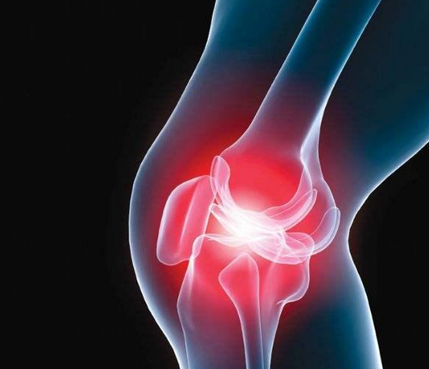 小针刀可以治疗膝关节骨性关节炎,小针刀治疗膝关节骨性关节炎是一种