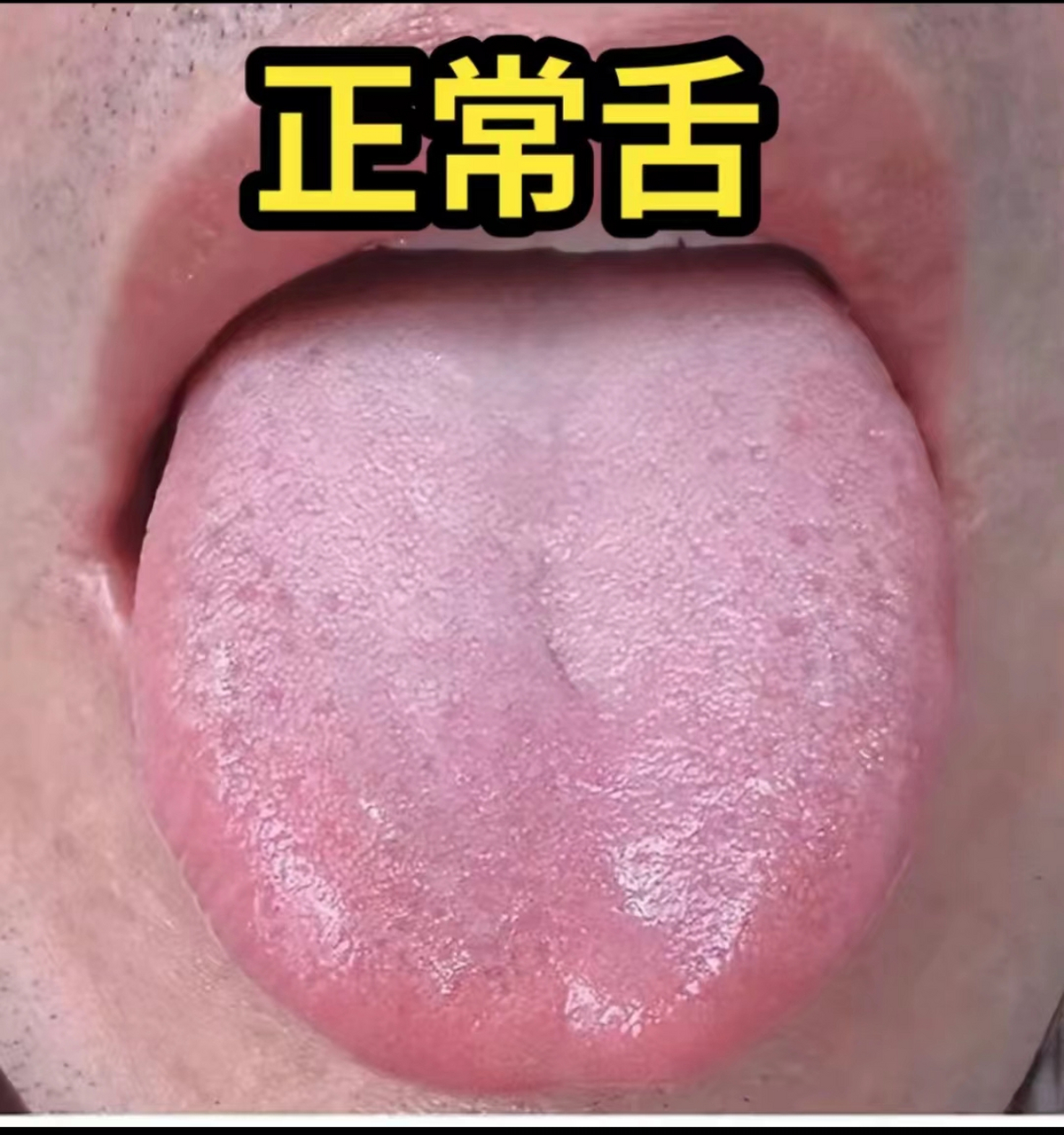 健康的舌头是什么样子图片