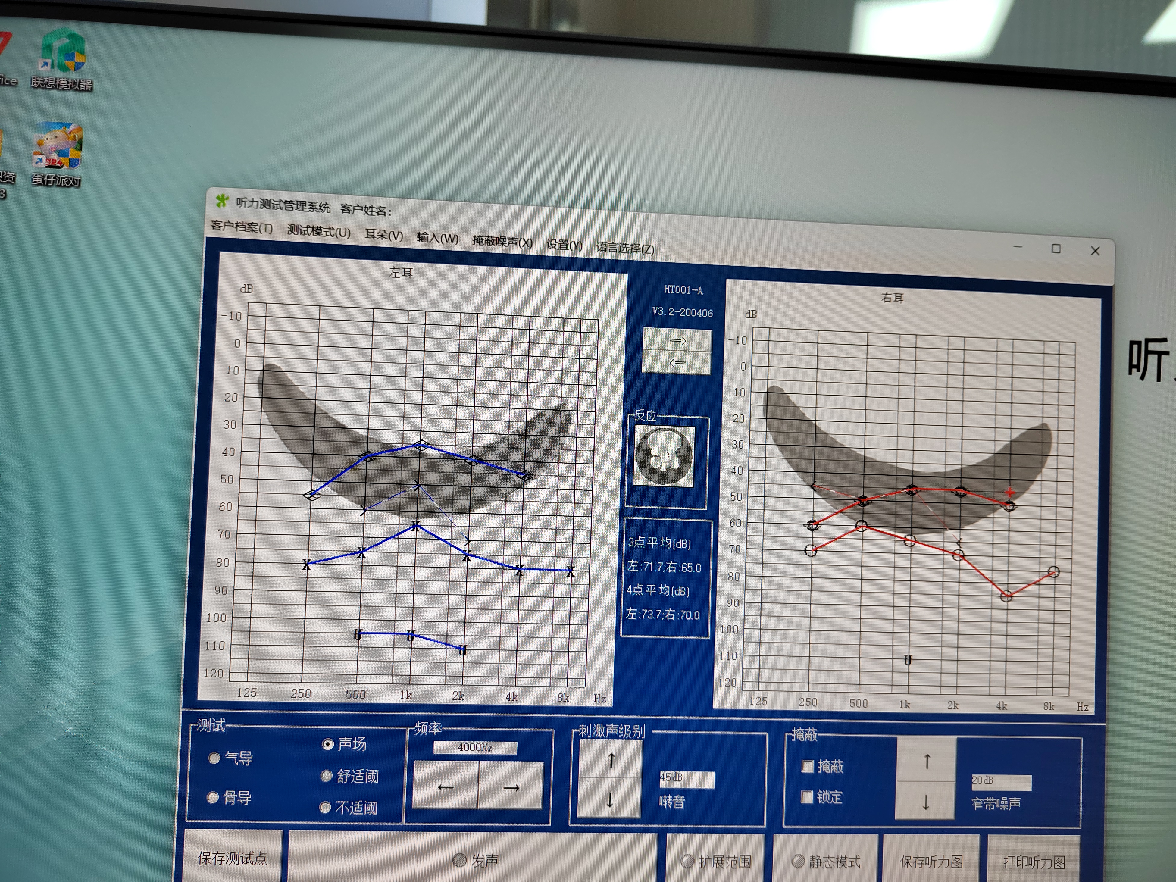 你的助听器是什么样子的? 看看我们的小耳朵,带上助听器交流无障碍