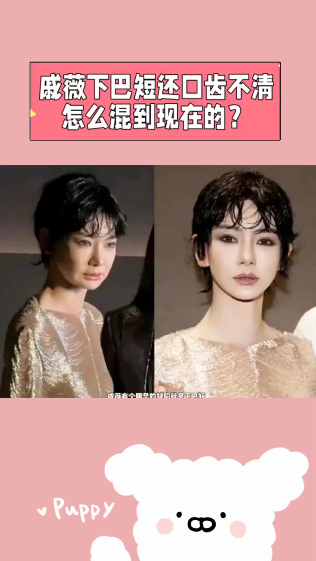 戚薇下巴短还口齿不清怎么混到现在的