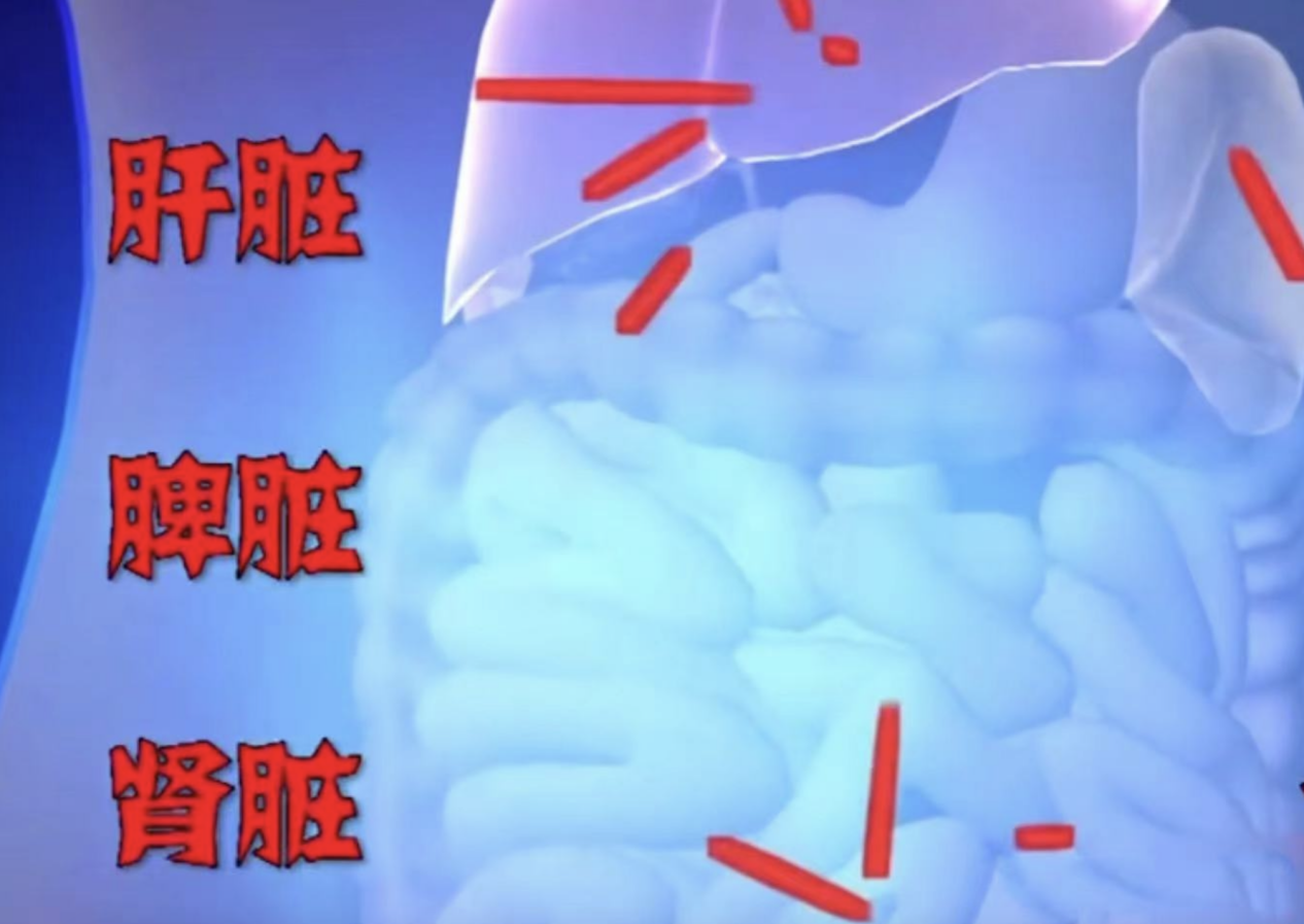 ""有五根,位置非常危险,肝脏,脾脏,肾脏还有大肠,而且一直处在不断