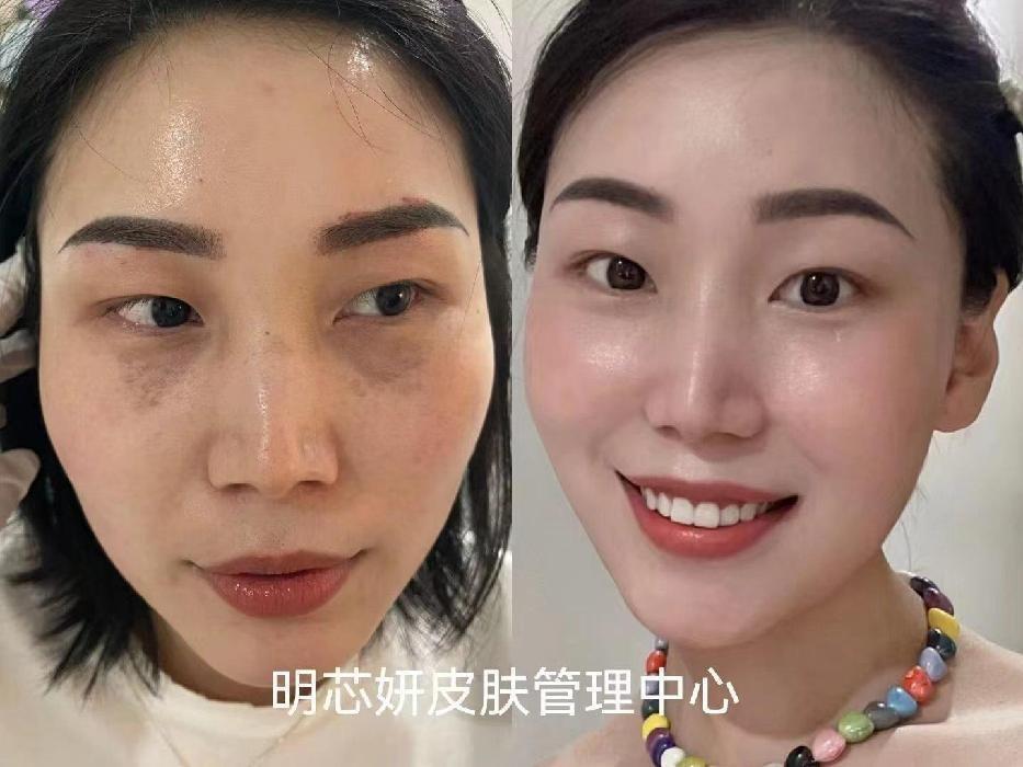 致敬奋斗的美业青年西部美业新青年大赛人气亚军