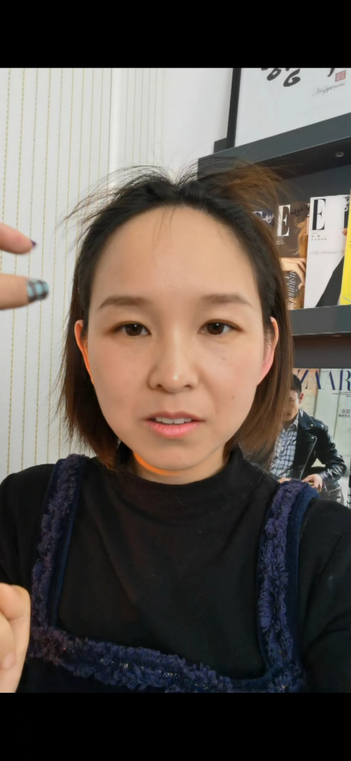 植发后结婚(植发后能怀孕吗)