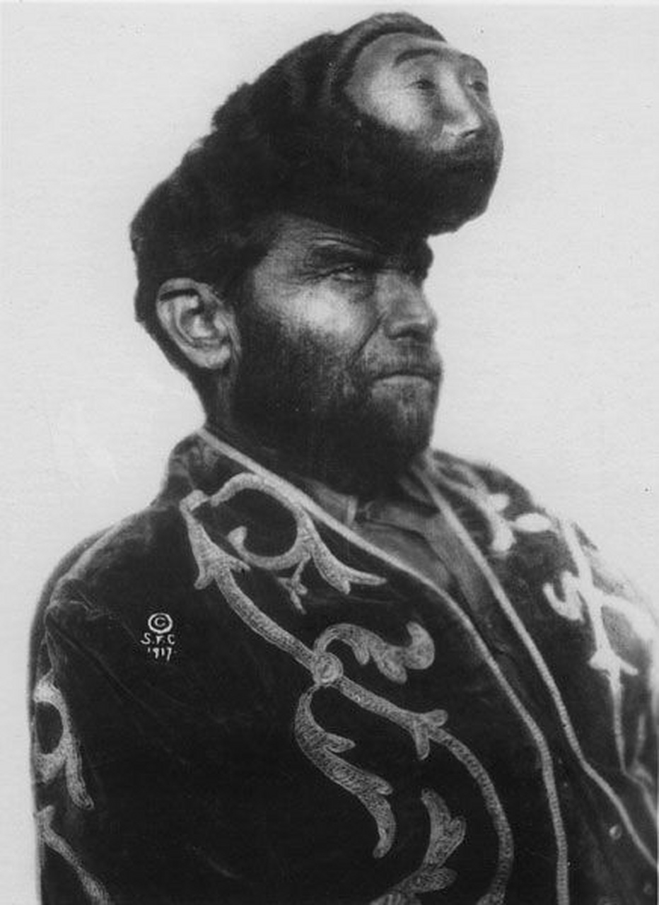 生前是一位马戏团演员,很多人买票进场,就是为了一睹他的"双头"