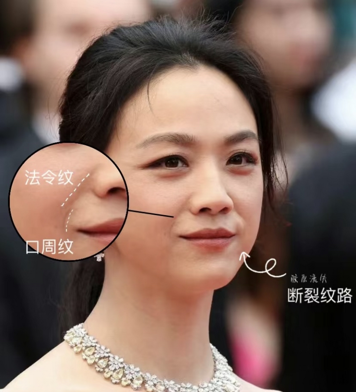 面相中最准确的寿数密码?法令纹深浅关联命运,古谚道破生死玄机