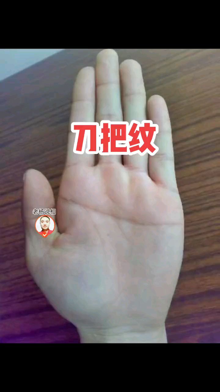 断掌纹,又称刀把纹.