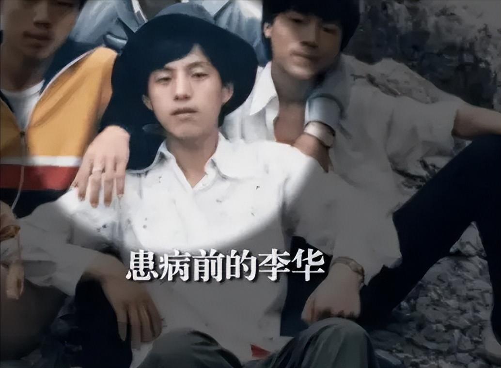 回顾折叠人李华骨头被敲断3次植入22颗钢钉如今重获新生