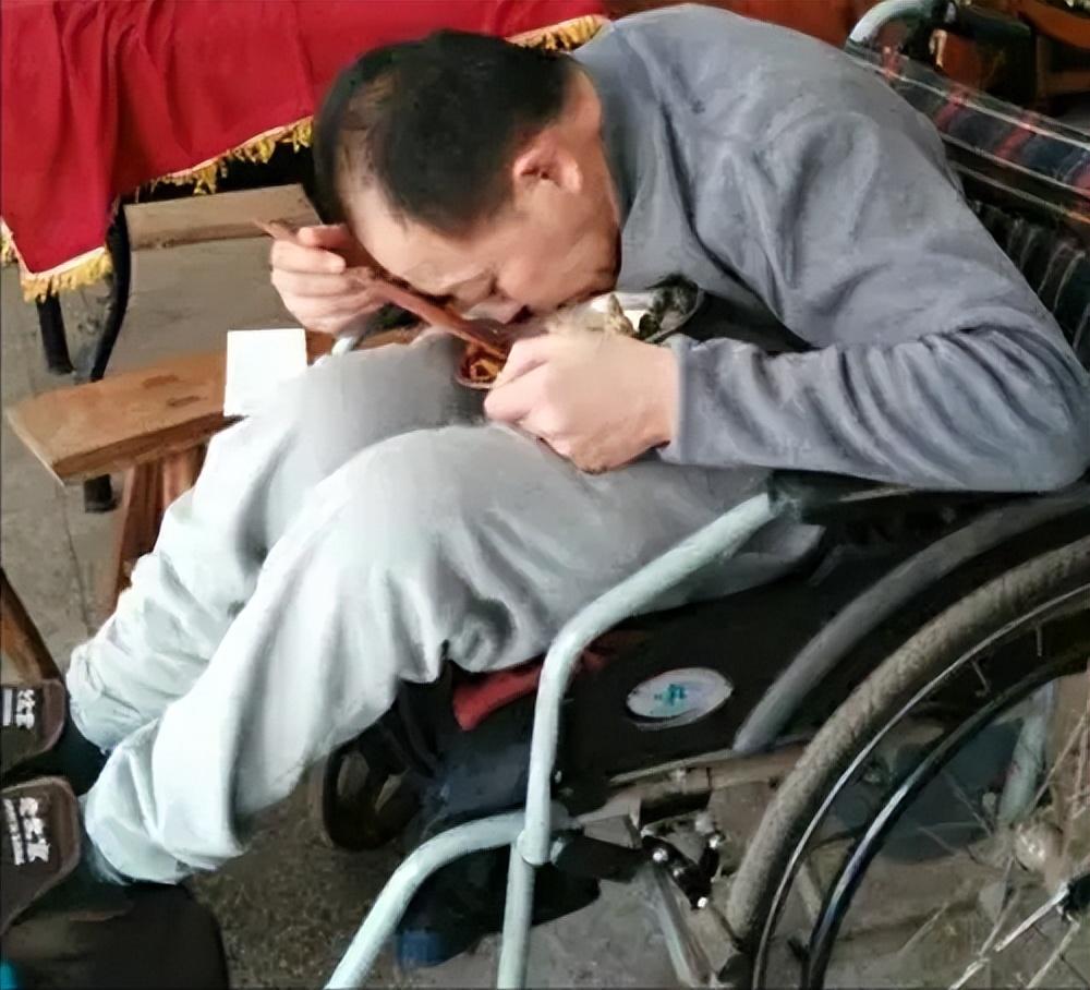 回顾折叠人李华骨头被敲断3次植入22颗钢钉如今重获新生