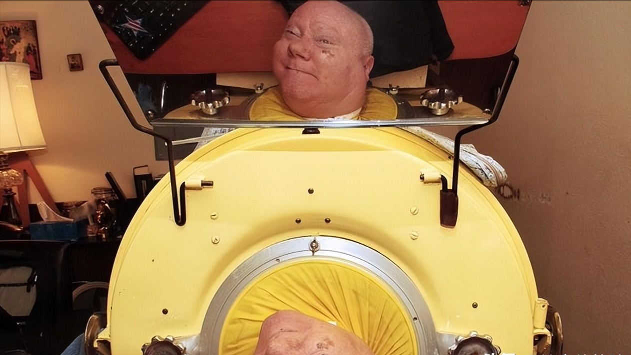 回顾世界最后一个铁肺人被困铁桶71年却靠毅力逆袭成为律师