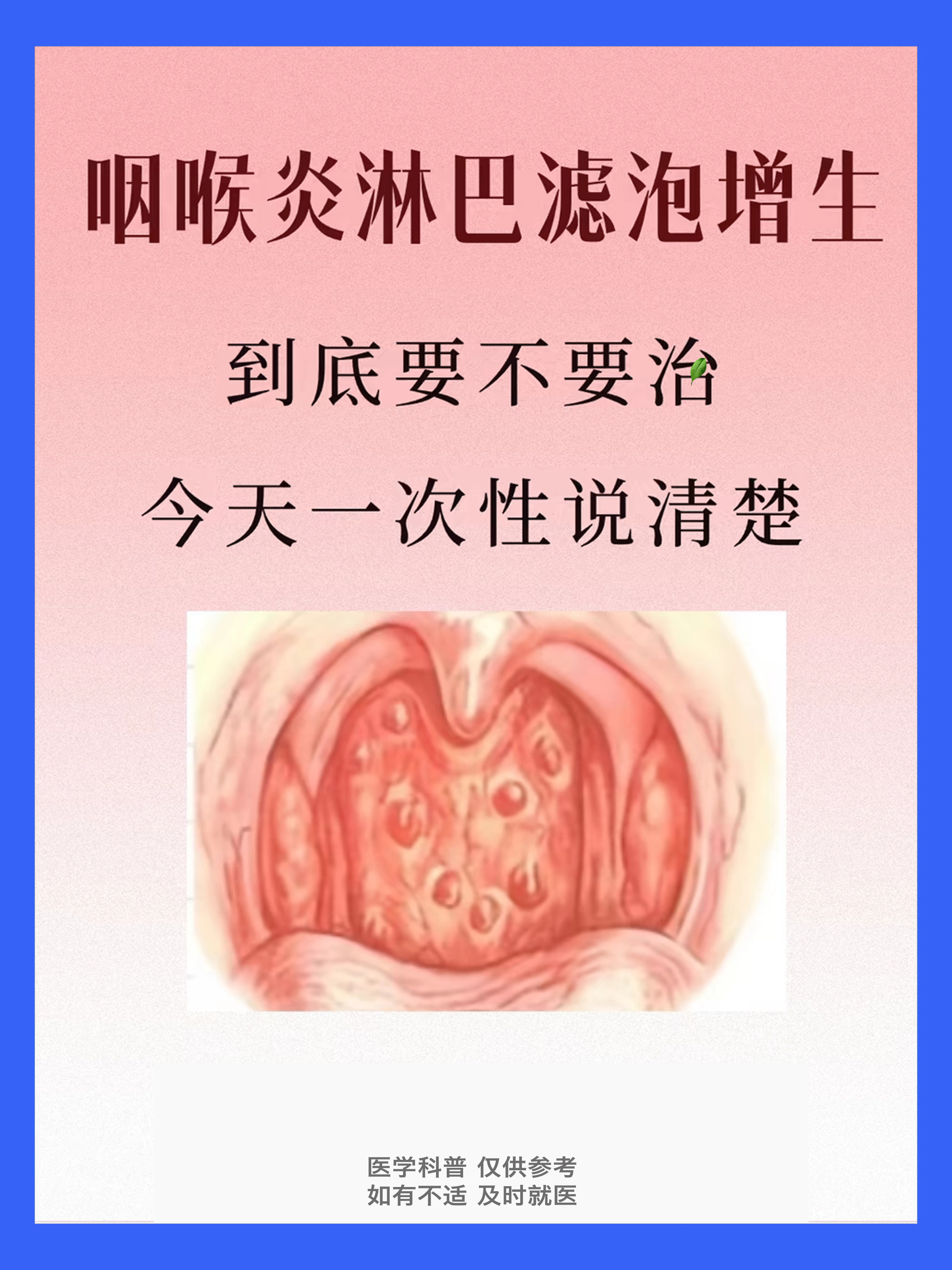 咽喉炎淋巴滤泡增生到底要不要.@耳鼻喉娄卫华的动态