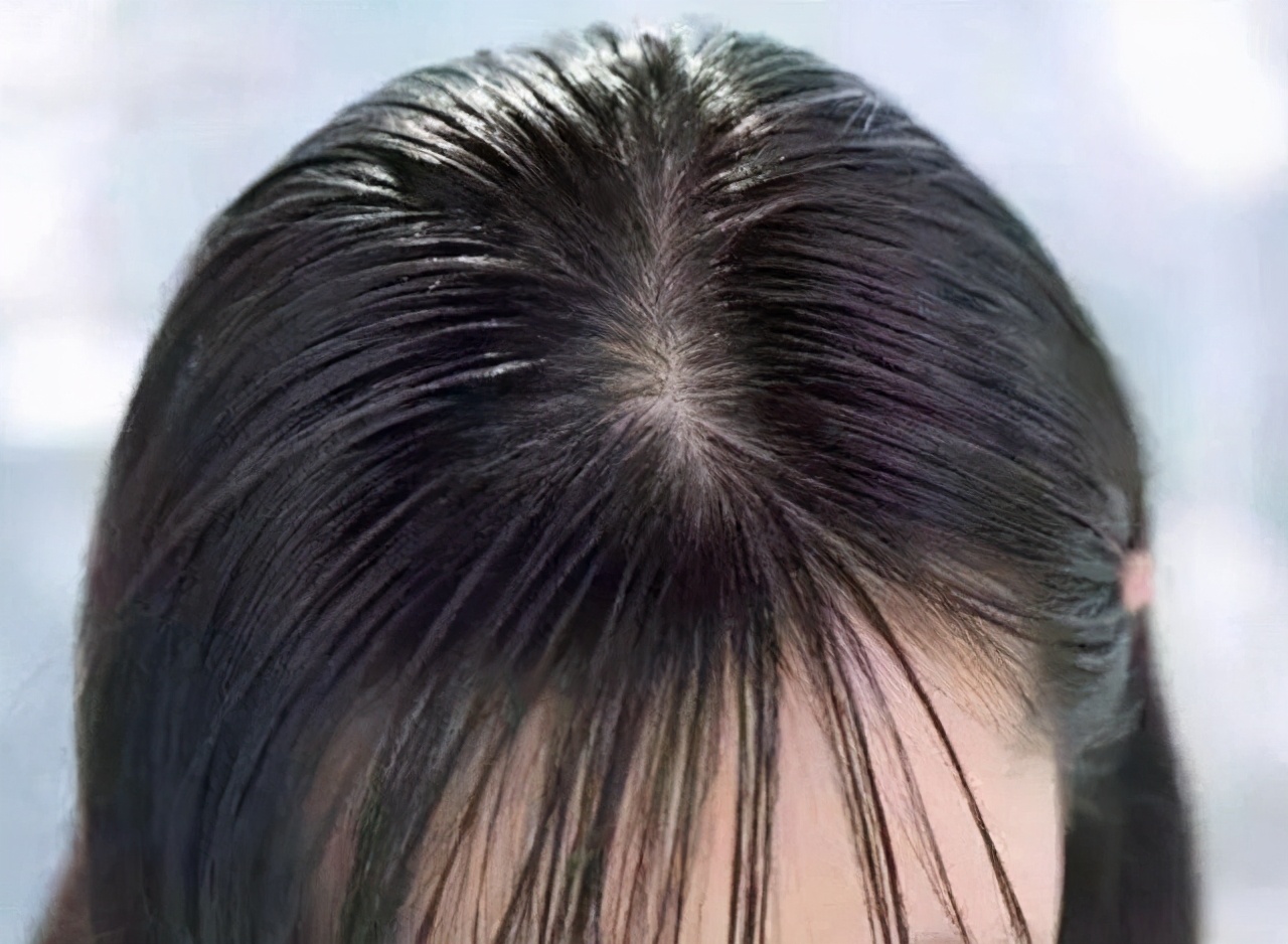 肝开始变硬,头部或有4个异常,若一个也没有,说明肝脏还很健康