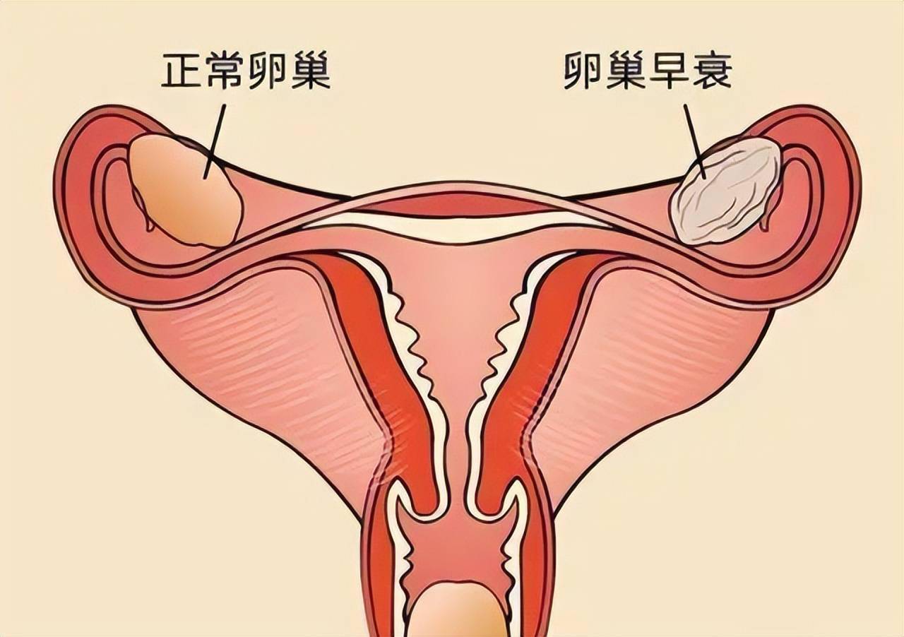 卵巢长什么样位置图片