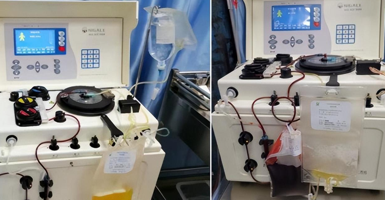 2011年云南女学生捐骨髓救人患者康复后却大骂她真不是东西