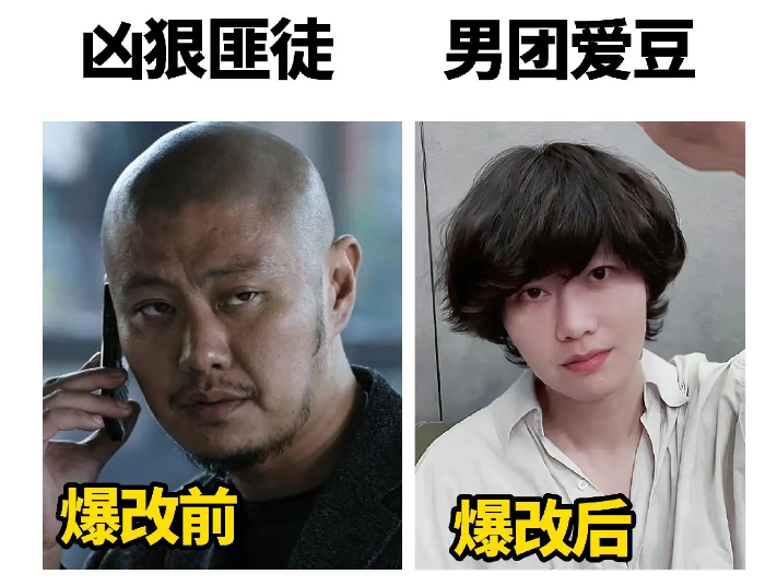 回顾39岁赵荀从李二牛改成花美男他的骨盆用3颗钉子挂在腰上