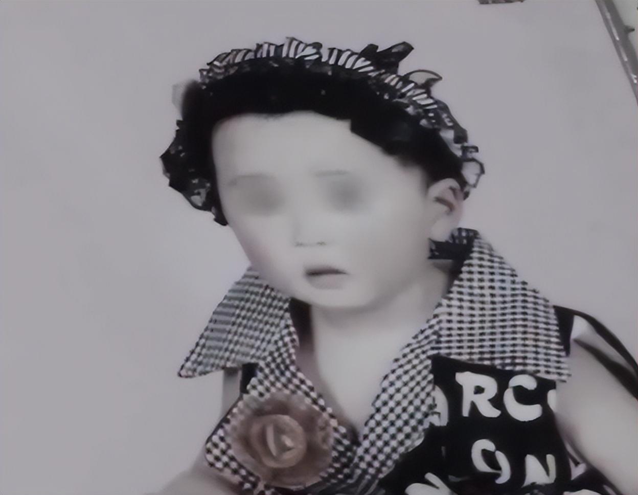 15年武汉8岁女童患怪病为保命全身移植猪皮引出离奇身世