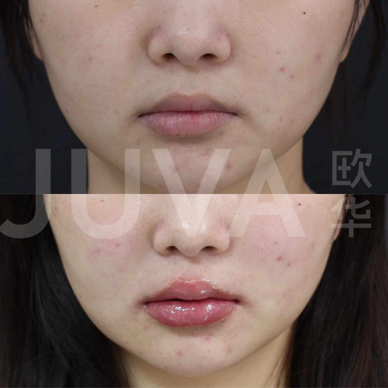 唇红体较扁且存在明显唇纹.  调整思路: 1.