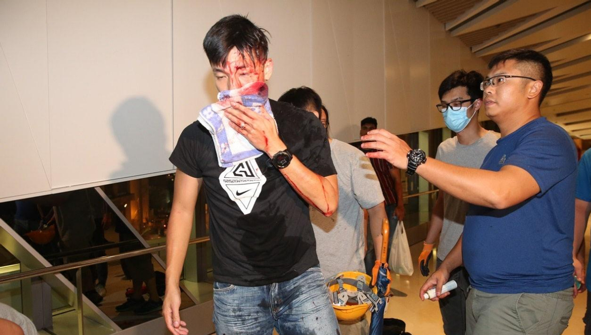 警方接到报警大浦黄宜坳发生炭烧事件香港著名记者柳俊江于家中自杀