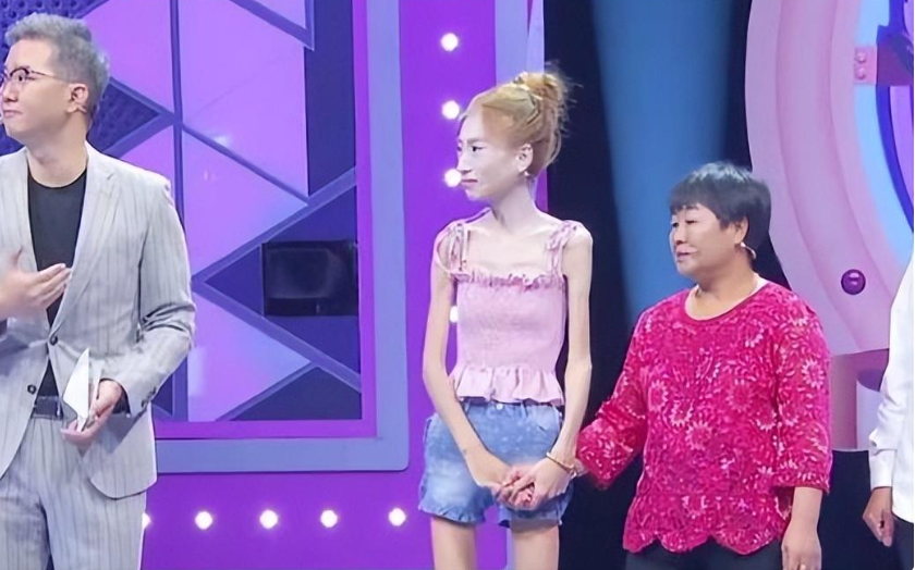 回顾:黑龙江骷髅女孩为前任,不顾医生劝120斤减58斤,后来后悔没