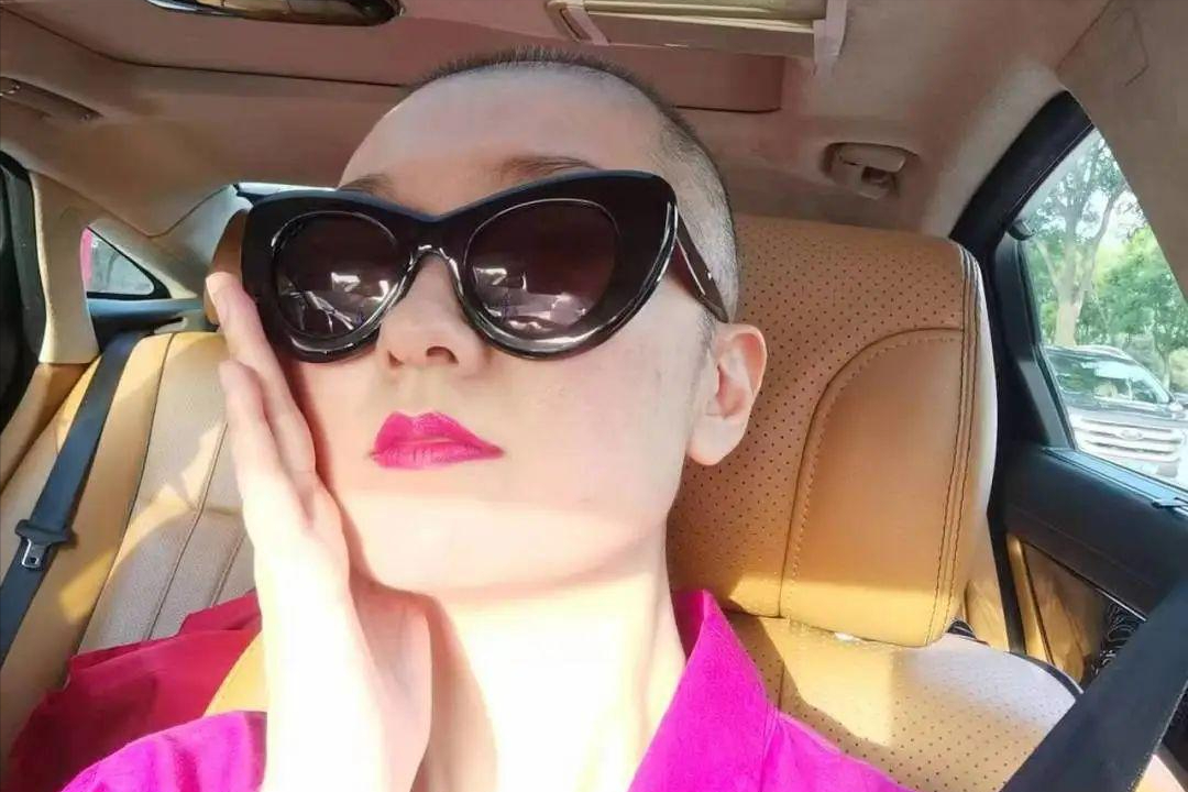 回顾主持人王静去世从确诊到去世仅七个月头发掉光令人心疼