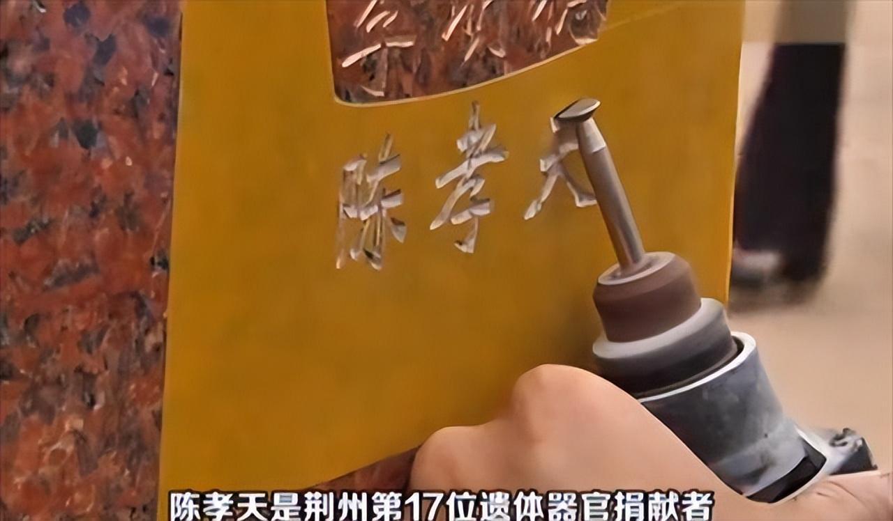 2014年湖北母亲因尿毒症接受肾脏移植肾源却是来自7岁儿子