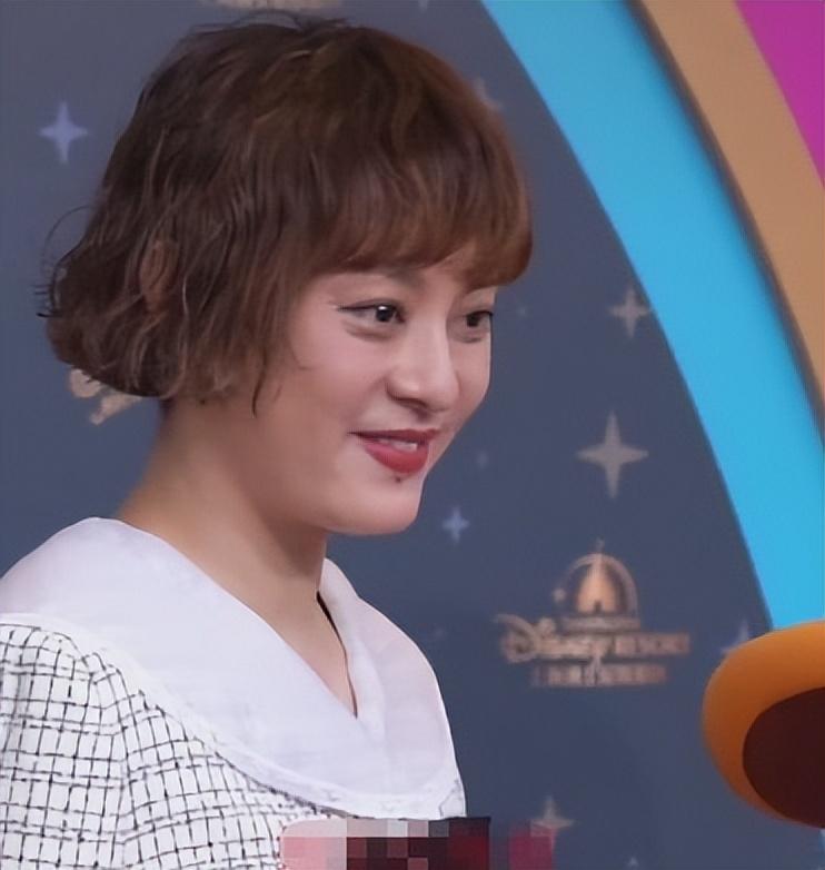 孙俪突然变美眼睛不凸也不发腮了下巴的痣引热议被指整容