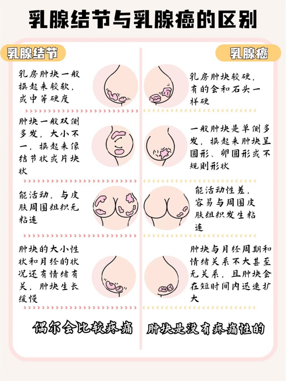 乳腺腺体致密图片