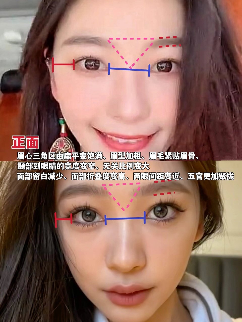 聊聊易梦玲的眉心三角区