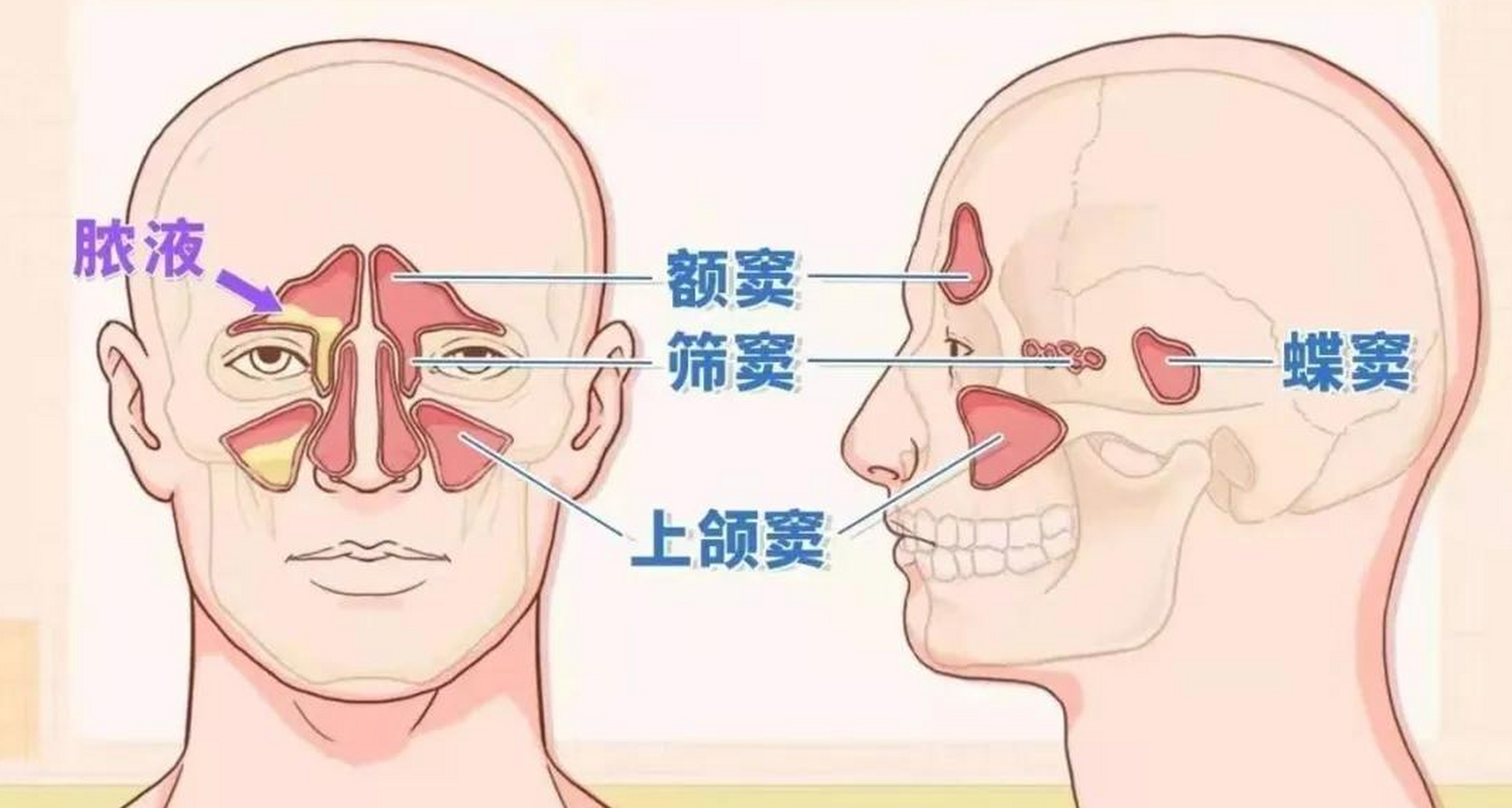 鼻旁窦的位置图片