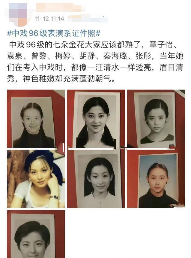 回顾秦海璐给单眼皮上千万保险产下巨婴症儿子险哭瞎双眼