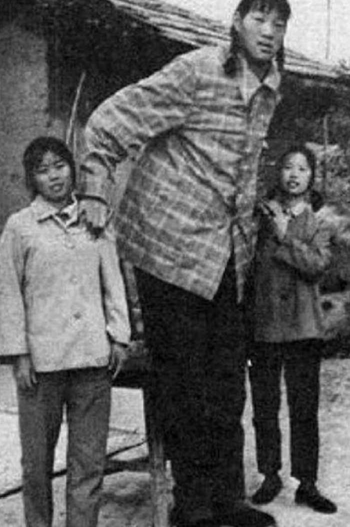 回顾女巨人曾金莲身高2米36却在18岁猝死遗体捐献科学研究