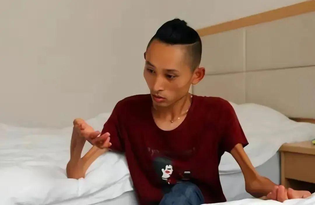 回顾纪实男子患渐冻症28岁登上泰山30岁娶漂亮老婆如今怎样了