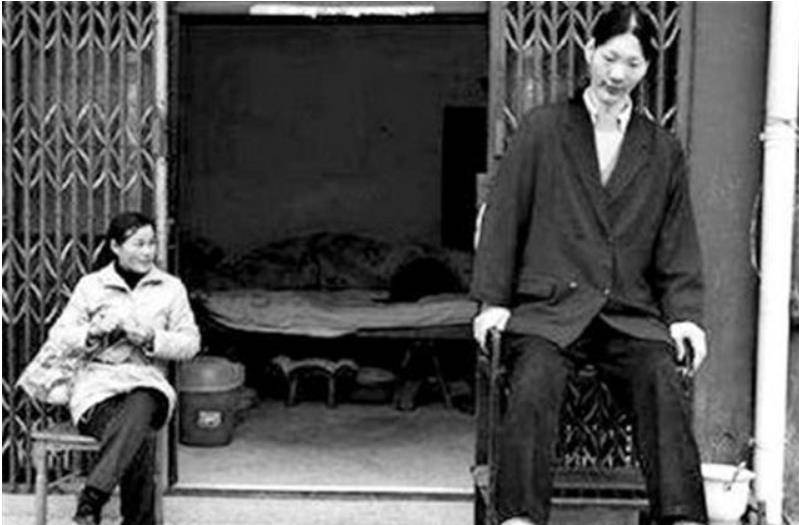 回顾女巨人曾金莲身高2米36却在18岁猝死遗体捐献科学研究