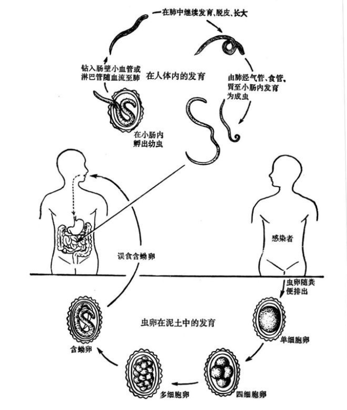 蛔虫简笔画图片大全图片