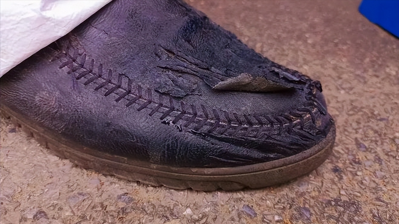 2015年吉林父亲每天暴走20公里走烂30双袜子为救儿子狂瘦50斤