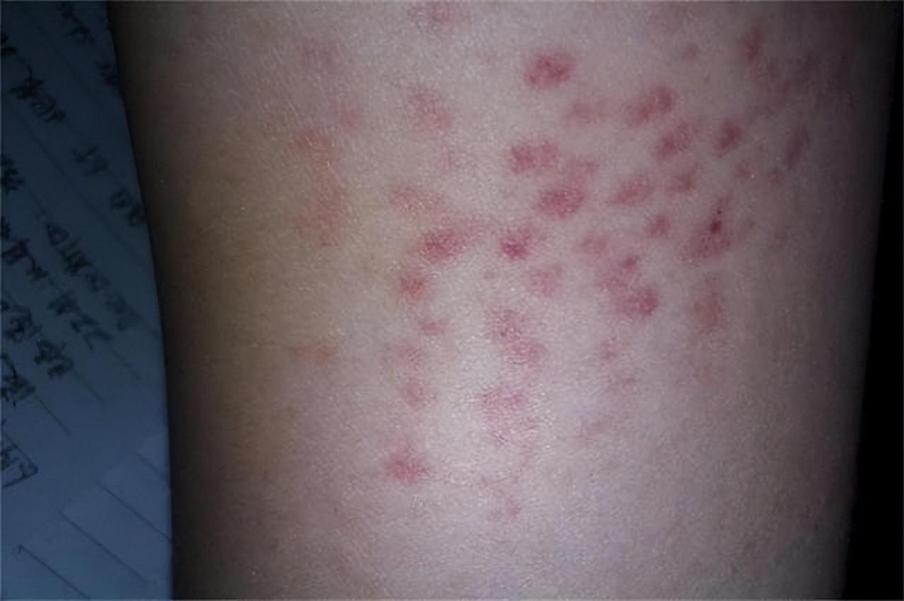 05年四川8岁白血病女孩不愿拖累养父悄悄写下自愿放弃治疗